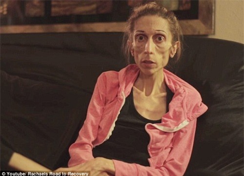 hanh trinh lot xac than ky cua co gai da boc xuong tro thanh thien nga xinh dep - 4