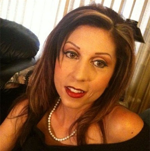 hanh trinh lot xac than ky cua co gai da boc xuong tro thanh thien nga xinh dep - 8