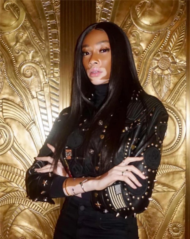 Sau gần 1 thập kỷ giấu mặt sau lớp trang điểm, cô gái lau mặt đi trong sự ngỡ ngàng của mọi người - Ảnh 4.