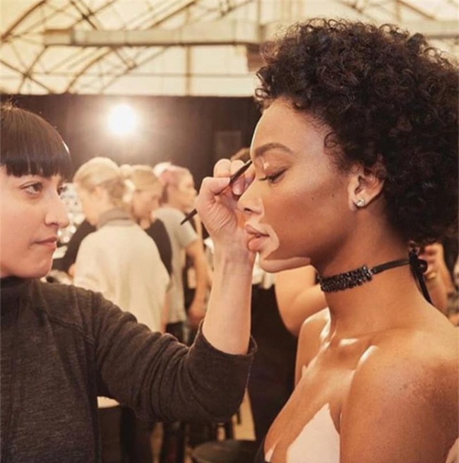 Sau gần 1 thập kỷ giấu mặt sau lớp trang điểm, cô gái lau mặt đi trong sự ngỡ ngàng của mọi người - Ảnh 5.