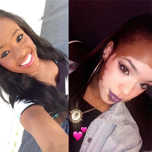 Sau gần 1 thập kỷ giấu mặt sau lớp trang điểm, cô gái lau mặt đi trong sự ngỡ ngàng của mọi người - Ảnh 8.