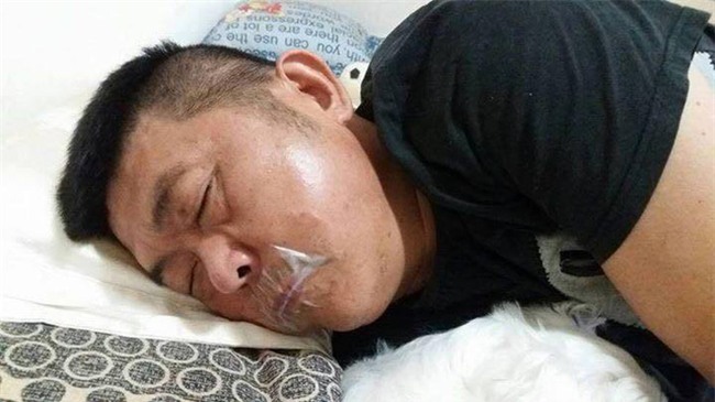 Vợ sốc nặng khi thấy miệng chồng dán băng keo nhưng sự thật phía sau đã khiến cô phải bật khóc - Ảnh 1.