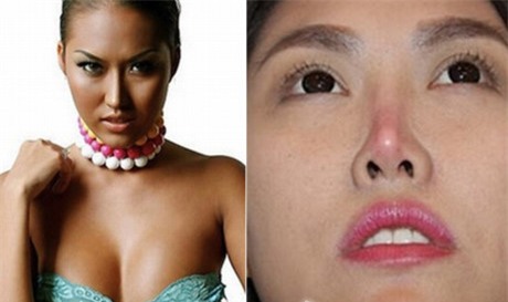 Nhan sắc của Phi Thanh Vân sau phẫu thuật thẩm mỹ -5