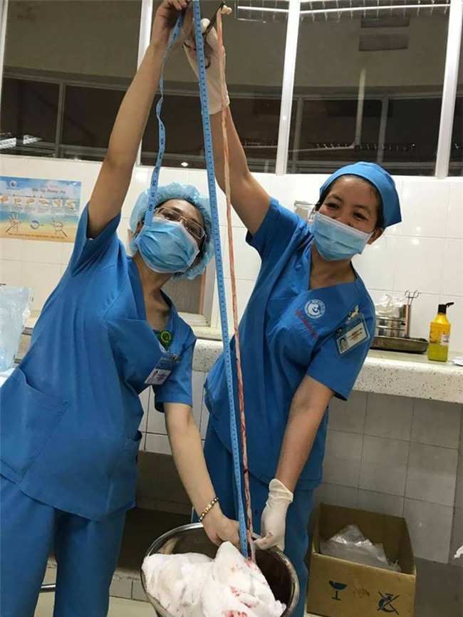 thai phụ, dây rốn quấn cổ, Bệnh viện Từ Dũ, thai nhi