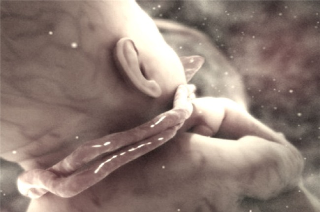 thai phụ, dây rốn quấn cổ, Bệnh viện Từ Dũ, thai nhi