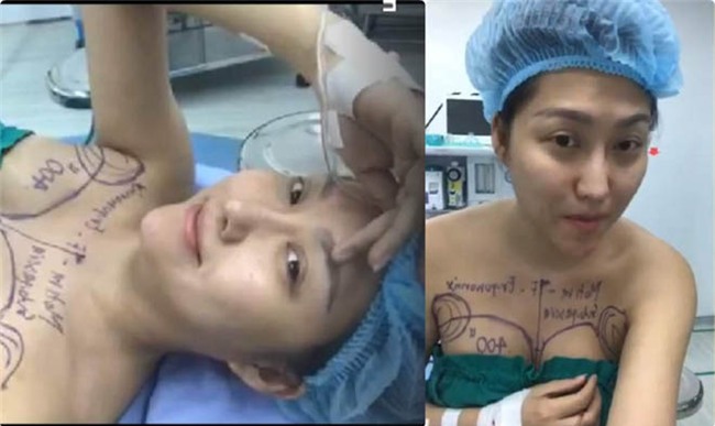 "Rợn người" trước quá trình đại phẫu 45 tiếng của Phi Thanh Vân - 2
