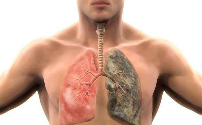 Thanh lọc sạch mọi độc tố tích tụ trong phổi với 6 bước đơn giản ai cũng làm được