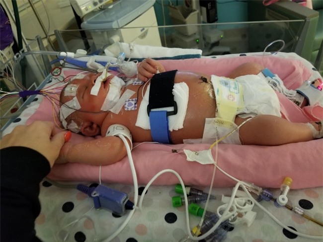 Chỉ vì một nụ hôn của người lạ, bé gái 18 ngày tuổi đã chết vì lây nhiễm virus viêm màng não - Ảnh 3.