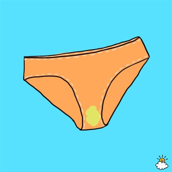 doan benh chuan xac qua dich tiet am dao - 3