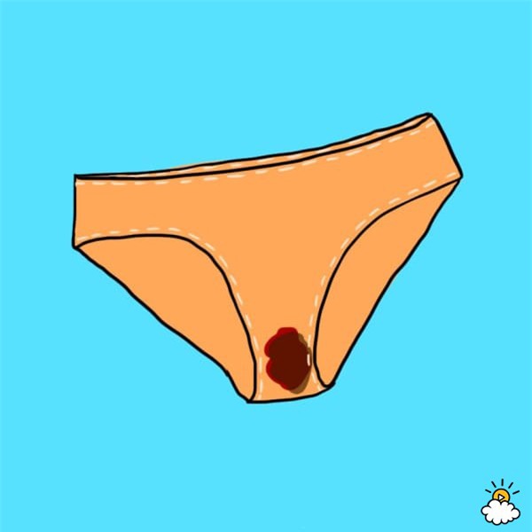 doan benh chuan xac qua dich tiet am dao - 4