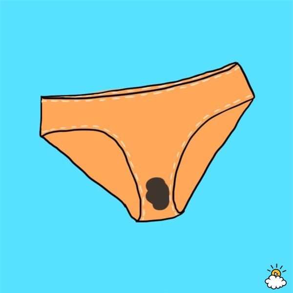 doan benh chuan xac qua dich tiet am dao - 7