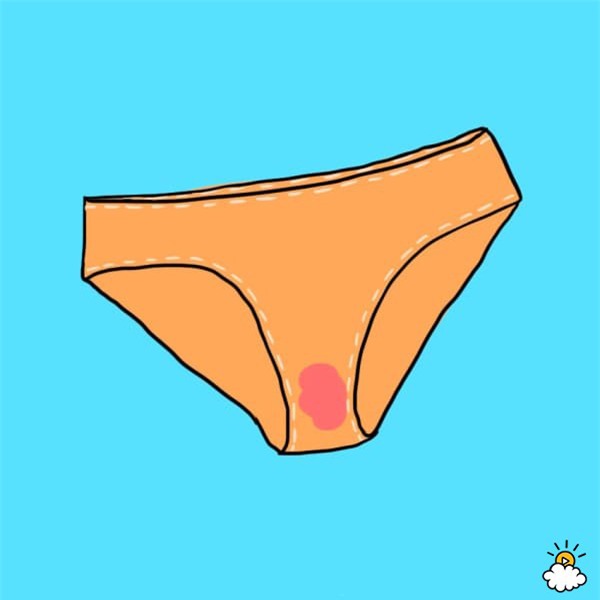 doan benh chuan xac qua dich tiet am dao - 8