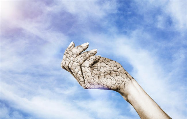 3 bệnh tiềm ẩn là thủ phạm khiến da bạn bị khô, ngứa, bong vảy... - Ảnh 1.