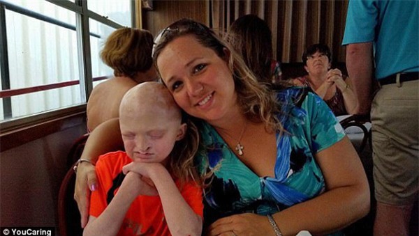 be 9 tuoi khong the khoc, khong do mo hoi do benh hiem gap, 1 trieu nguoi moi co 1 nguoi mac - 2