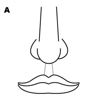 Đường nhân trung cũng quan trọng lắm chứ chẳng đùa, muốn biết tuổi thọ của mình cứ nhìn vào đây - Ảnh 1.