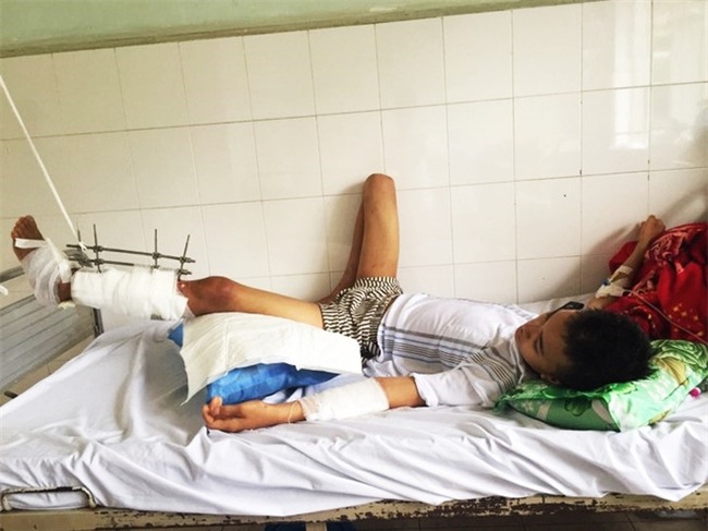 Thiếu niên máu hiếm bị xe cán nát đôi chân, mẹ khẩn cầu cộng đồng mạng và kết quả khiến nhiều người xúc động - Ảnh 1.