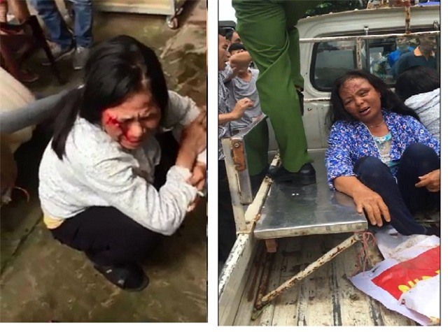 su that dau long phia sau vu hai nguoi phu nu bi danh bam giap vi nghi bat coc tre con o ha noi - 1