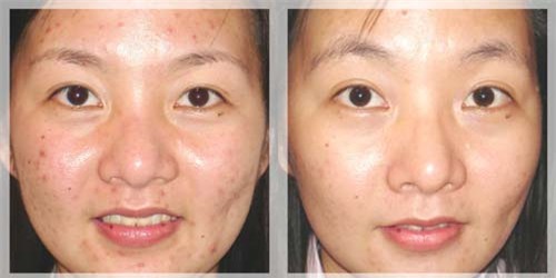 1 qua chanh –  5 cong dung lam dep hieu qua hon ca my pham tien trieu - 3