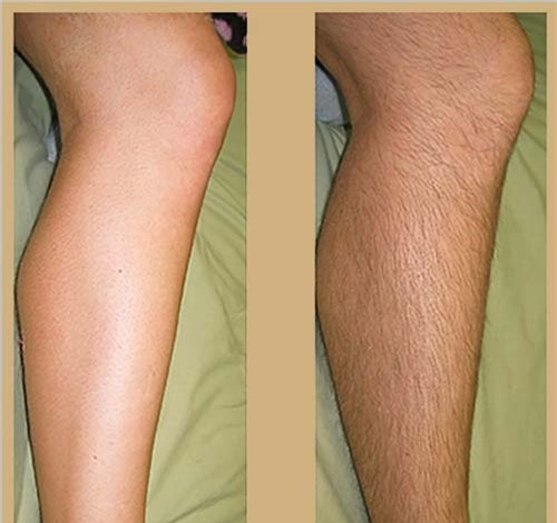 1 qua chanh – 5 cong dung lam dep hieu qua hon ca my pham tien trieu - 5