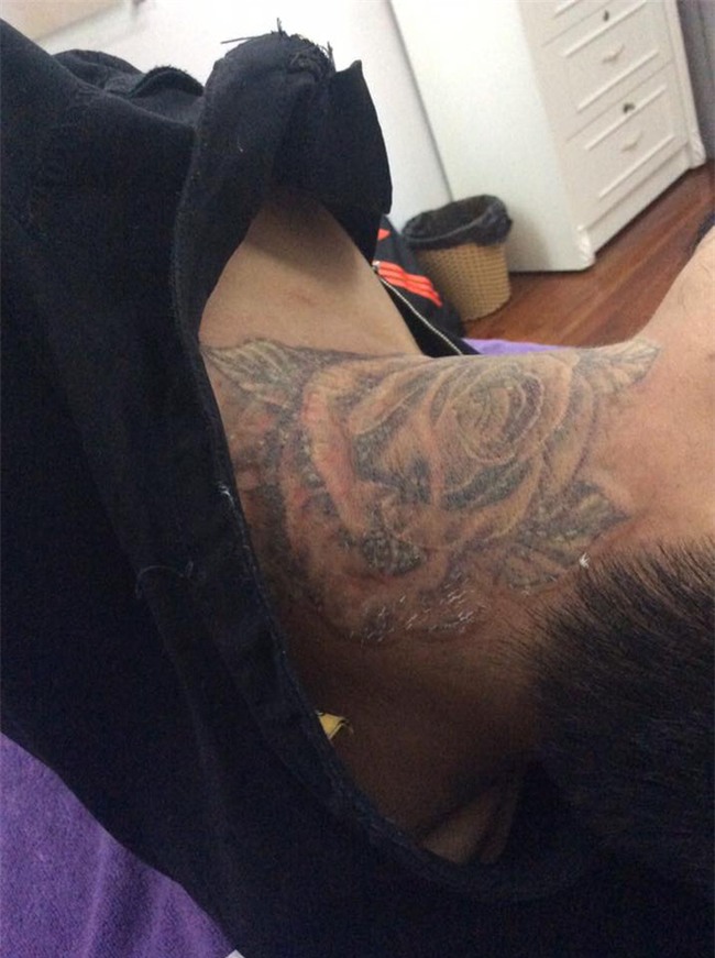 Dân mạng phát khiếp với hình ảnh xóa xăm đầy đau đớn của 9x Sài thành - Ảnh 6.