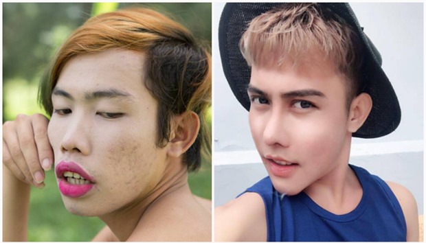 Không thể nhận ra Tùng Sơn sau khi phẫu thuật đại tu nhan sắc! - Ảnh 2.