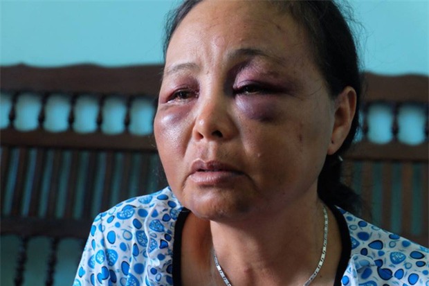 Người phụ nữ bán tăm bị đánh oan vì tưởng bắt cóc trẻ em: Chỉ vì lời 1 cô gái mà họ lao vào đấm, đá túi bụi chúng tôi - Ảnh 4.