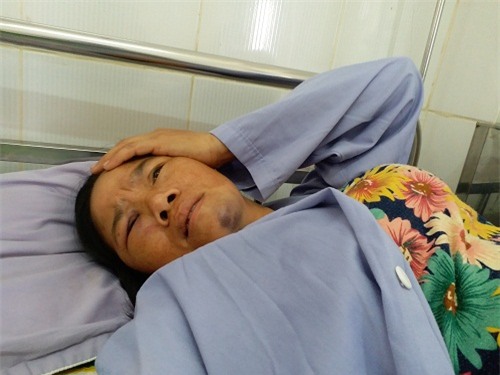 2 nguoi phu nu bi danh vi nghi bat coc tre con: "toi bang hoang khi ho bao vo bi danh chet roi" - 3