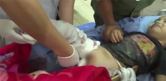 Bé trai 4 tuổi bị cụt chân do đá tảng lăn xuống nhà đè nát đôi chân đã qua cơn nguy kịch - Ảnh 1.