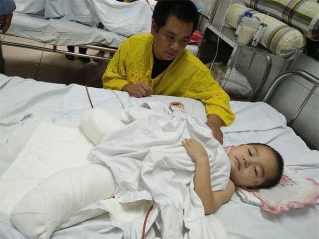 Bé trai 4 tuổi bị cụt chân do đá tảng lăn xuống nhà đè nát đôi chân đã qua cơn nguy kịch - Ảnh 2.