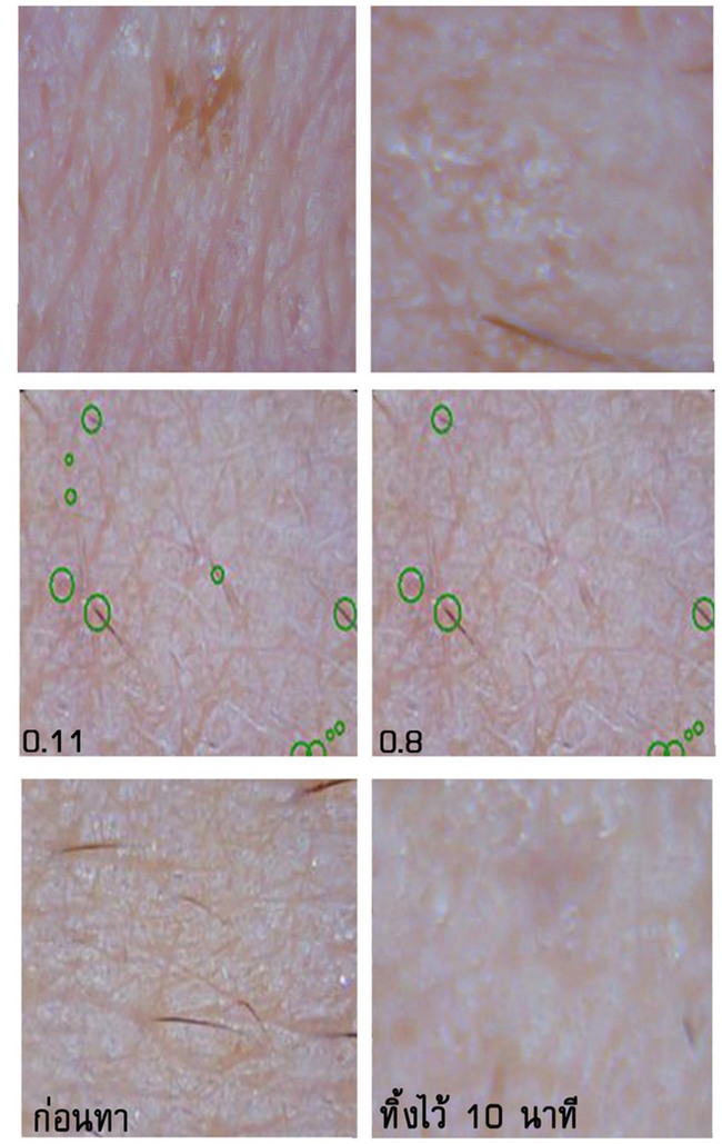 Soi đến tận chân tơ xem hiệu quả của 8 sản phẩm chống lão hóa phổ biến hiện nay - Ảnh 10.