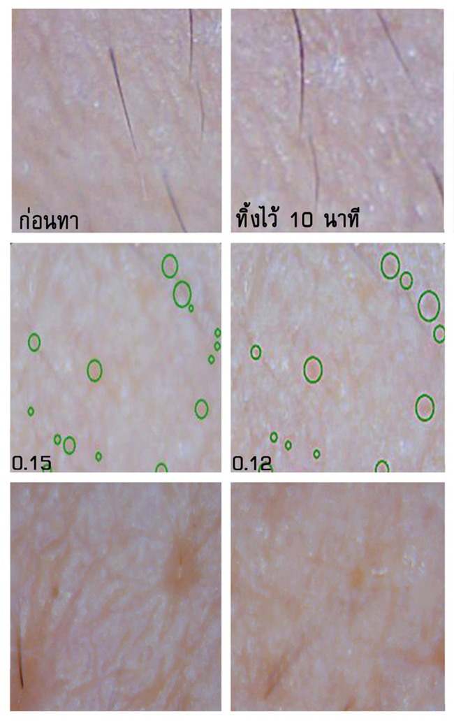 Soi đến tận chân tơ xem hiệu quả của 8 sản phẩm chống lão hóa phổ biến hiện nay - Ảnh 12.