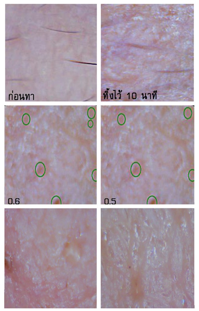 Soi đến tận chân tơ xem hiệu quả của 8 sản phẩm chống lão hóa phổ biến hiện nay - Ảnh 14.