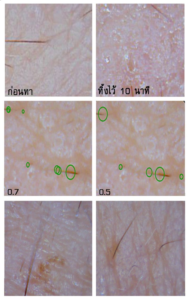 Soi đến tận chân tơ xem hiệu quả của 8 sản phẩm chống lão hóa phổ biến hiện nay - Ảnh 16.
