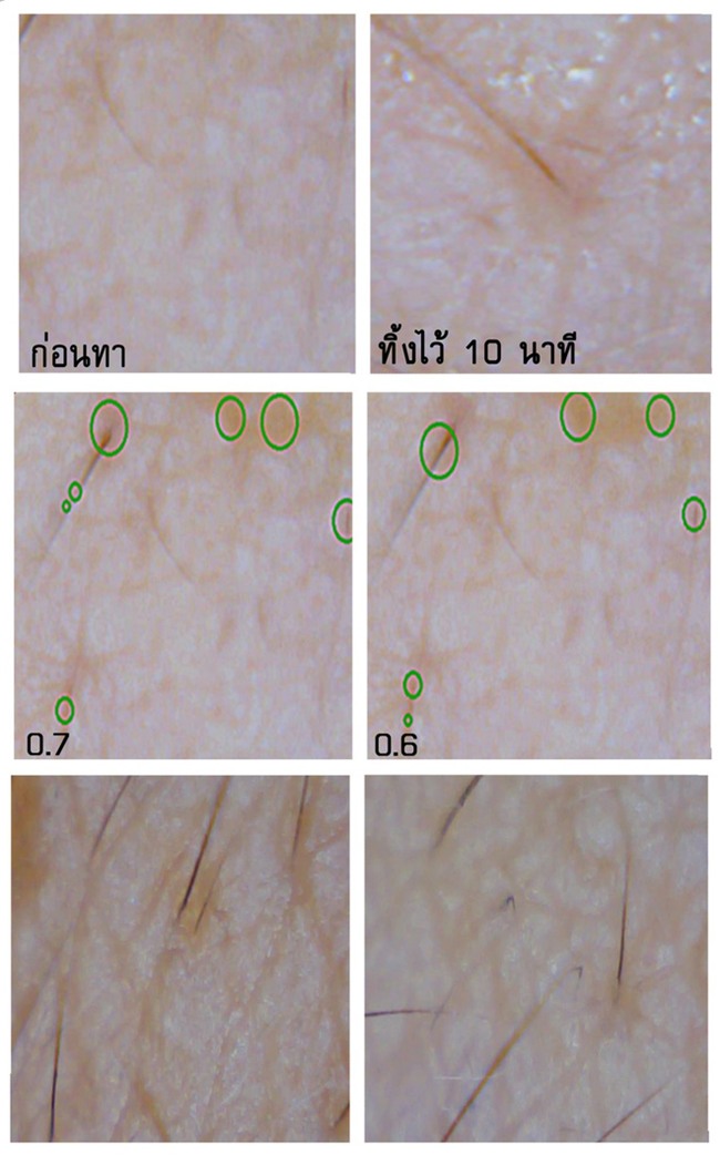 Soi đến tận chân tơ xem hiệu quả của 8 sản phẩm chống lão hóa phổ biến hiện nay - Ảnh 6.