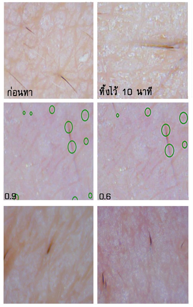 Soi đến tận chân tơ xem hiệu quả của 8 sản phẩm chống lão hóa phổ biến hiện nay - Ảnh 8.