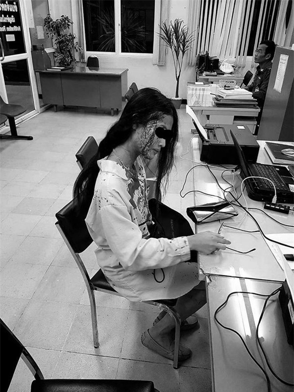 du mang thai 2 thang, co gai van bi ban trai giau co danh dap tan nhan, den muc phai nhap vien - 2