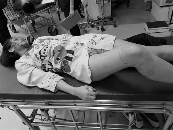 du mang thai 2 thang, co gai van bi ban trai giau co danh dap tan nhan, den muc phai nhap vien - 5