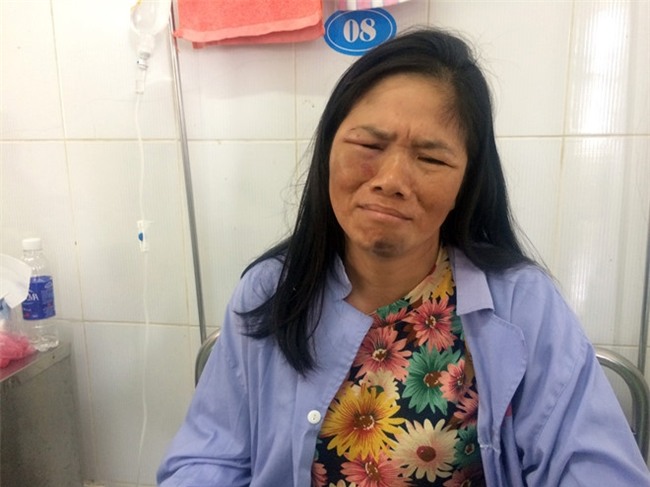 2 phu nu ban tam quyet lam ro dung sai sau vu bi danh nhap vien hinh anh 1