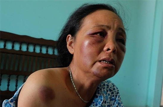 2 phu nu ban tam quyet lam ro dung sai sau vu bi danh nhap vien hinh anh 2