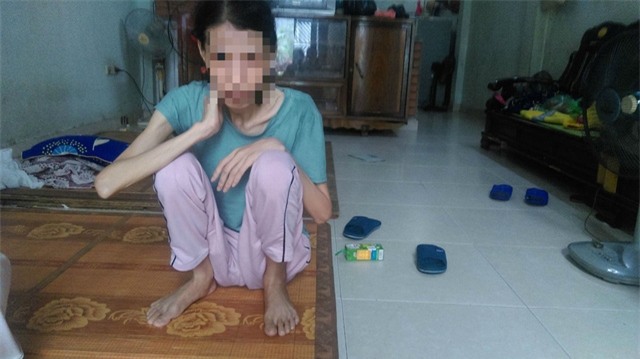 Trước đây chị Nguyễn Thị Điệp nặng 50kg, hiện tại chị nặng 33kg. Ảnh: Ngọc Thi