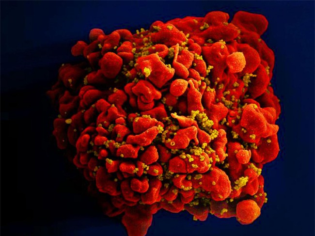 Ca nhiễm HIV thứ 3 trên thế giới được chữa khỏi - Ảnh 1.
