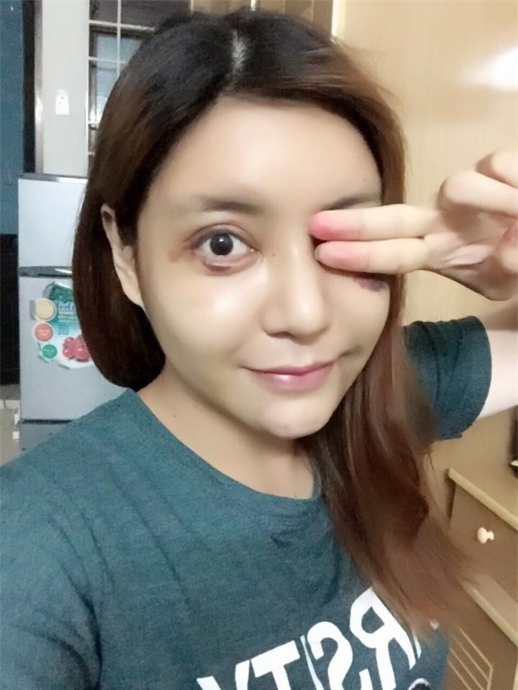 sao việt, mỹ nhân việt, sao phẫu thuật thẩm mỹ, ảnh dao kéo của sao, mỹ nhân việt phẫu thuật thẩm mỹ, phi thanh vân