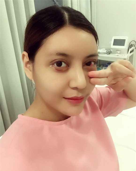 sao việt, mỹ nhân việt, sao phẫu thuật thẩm mỹ, ảnh dao kéo của sao, mỹ nhân việt phẫu thuật thẩm mỹ, phi thanh vân