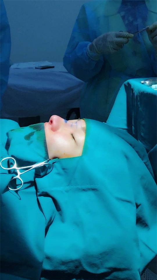 sao việt, mỹ nhân việt, sao phẫu thuật thẩm mỹ, ảnh dao kéo của sao, mỹ nhân việt phẫu thuật thẩm mỹ, phi thanh vân