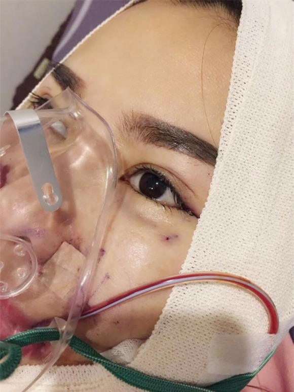 sao việt, mỹ nhân việt, sao phẫu thuật thẩm mỹ, ảnh dao kéo của sao, mỹ nhân việt phẫu thuật thẩm mỹ, phi thanh vân