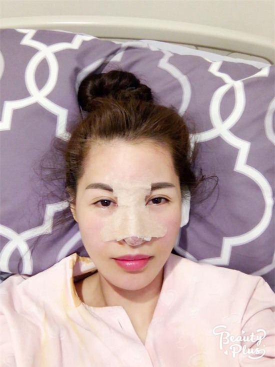 sao việt, mỹ nhân việt, sao phẫu thuật thẩm mỹ, ảnh dao kéo của sao, mỹ nhân việt phẫu thuật thẩm mỹ, phi thanh vân