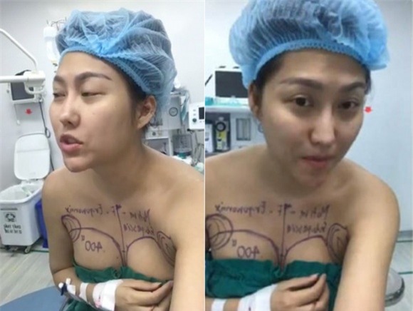 sao việt, mỹ nhân việt, sao phẫu thuật thẩm mỹ, ảnh dao kéo của sao, mỹ nhân việt phẫu thuật thẩm mỹ, phi thanh vân