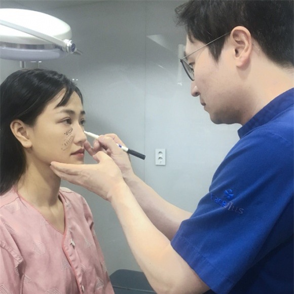 sao việt, mỹ nhân việt, sao phẫu thuật thẩm mỹ, ảnh dao kéo của sao, mỹ nhân việt phẫu thuật thẩm mỹ, phi thanh vân