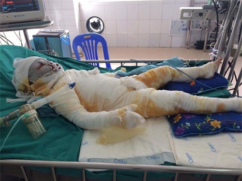 me bau 38 tuan cho con gai 4 tuoi di choi, khong ngo con gap nan tro thanh