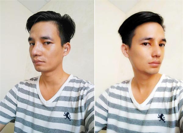 Hình ảnh đẹp trai của Lệ Rơi sau phẫu thuật thẩm mỹ khiến nhiều người ngỡ ngàng-1